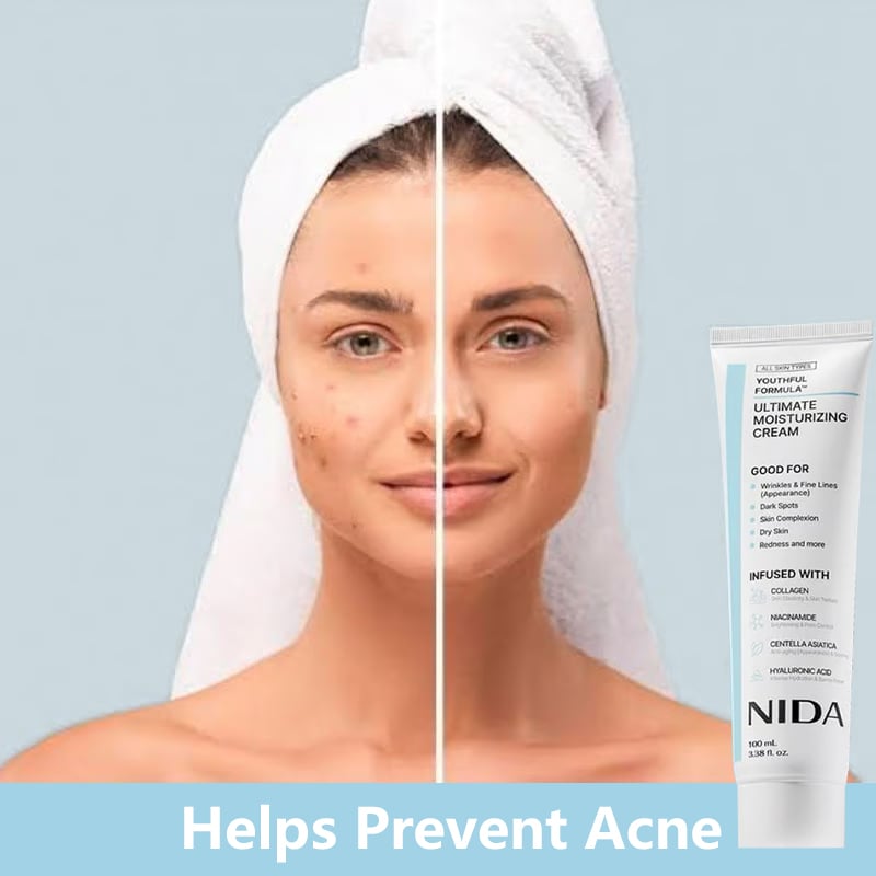 🎉Hot Sale 49% OFF🎉-NIDA Youthful Formula Ultimate Moisturizing Cream