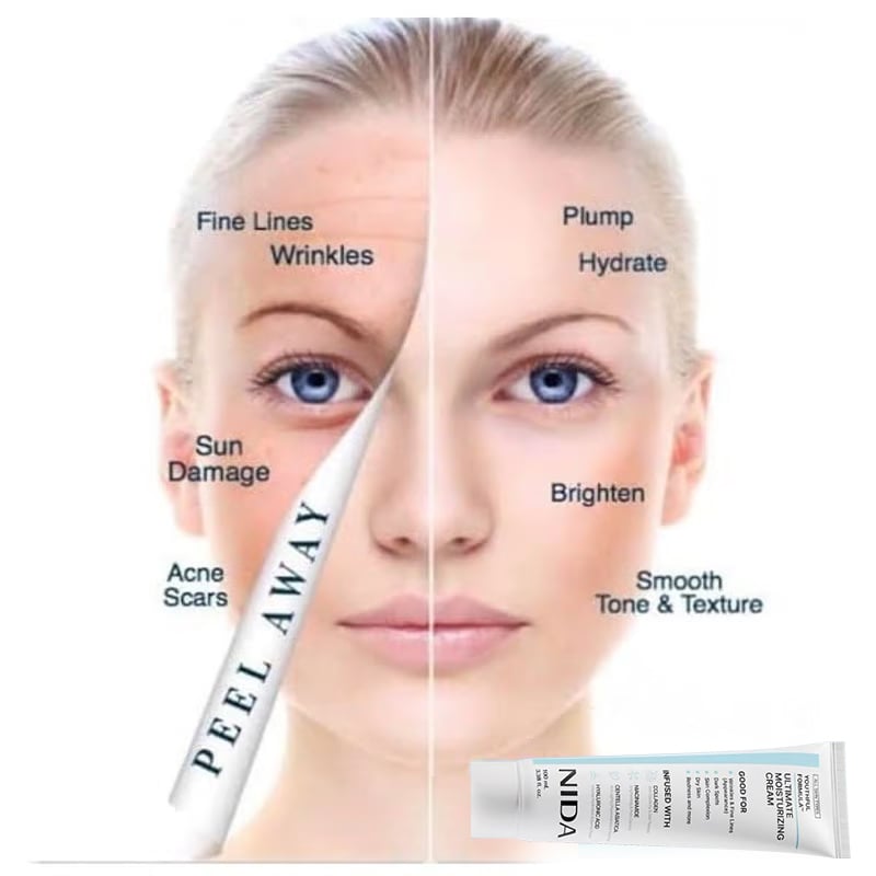 🎉Hot Sale 49% OFF🎉-NIDA Youthful Formula Ultimate Moisturizing Cream