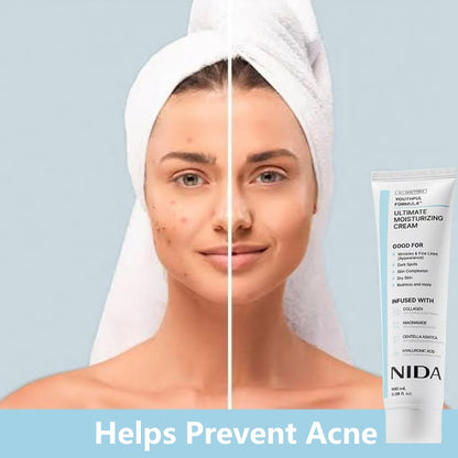 🎉Hot Sale 49% OFF🎉-NIDA Youthful Formula Ultimate Moisturizing Cream